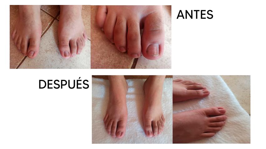 PediFix Podología Clínica