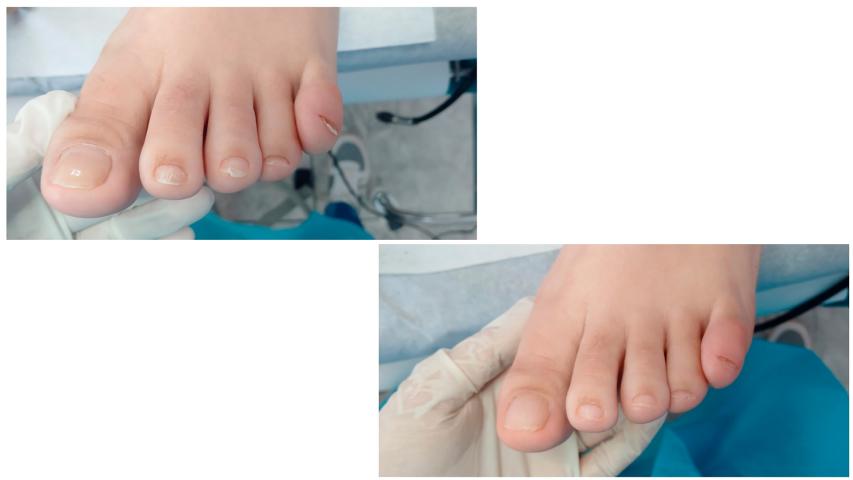 Fire Fly Nails